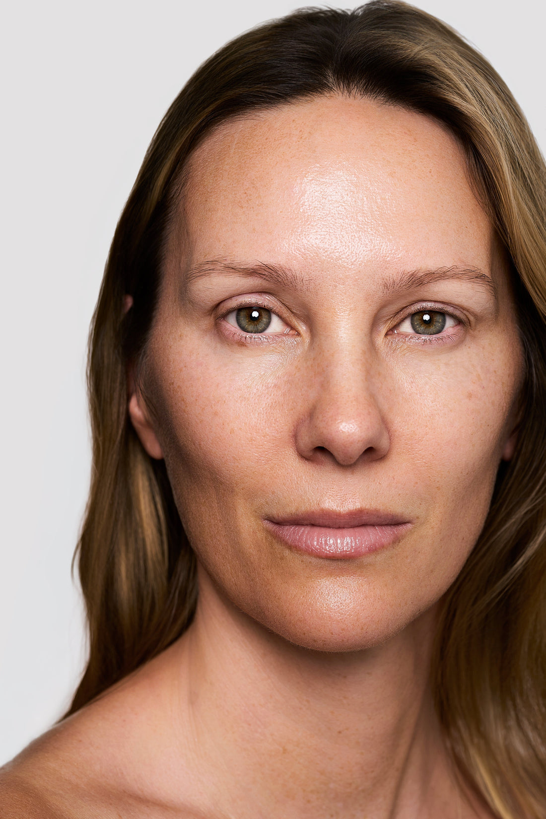 What is “Ozempic Face”: A Dermatologist Explains the Signs, Cause, and What Can Help