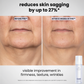 4-CLGN™ Peptide Duo