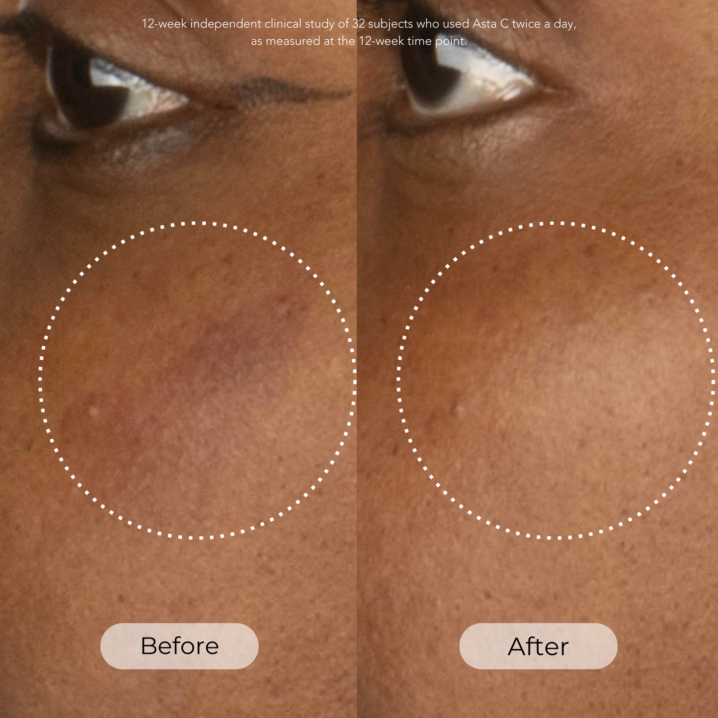 Collagen Recharge Duo