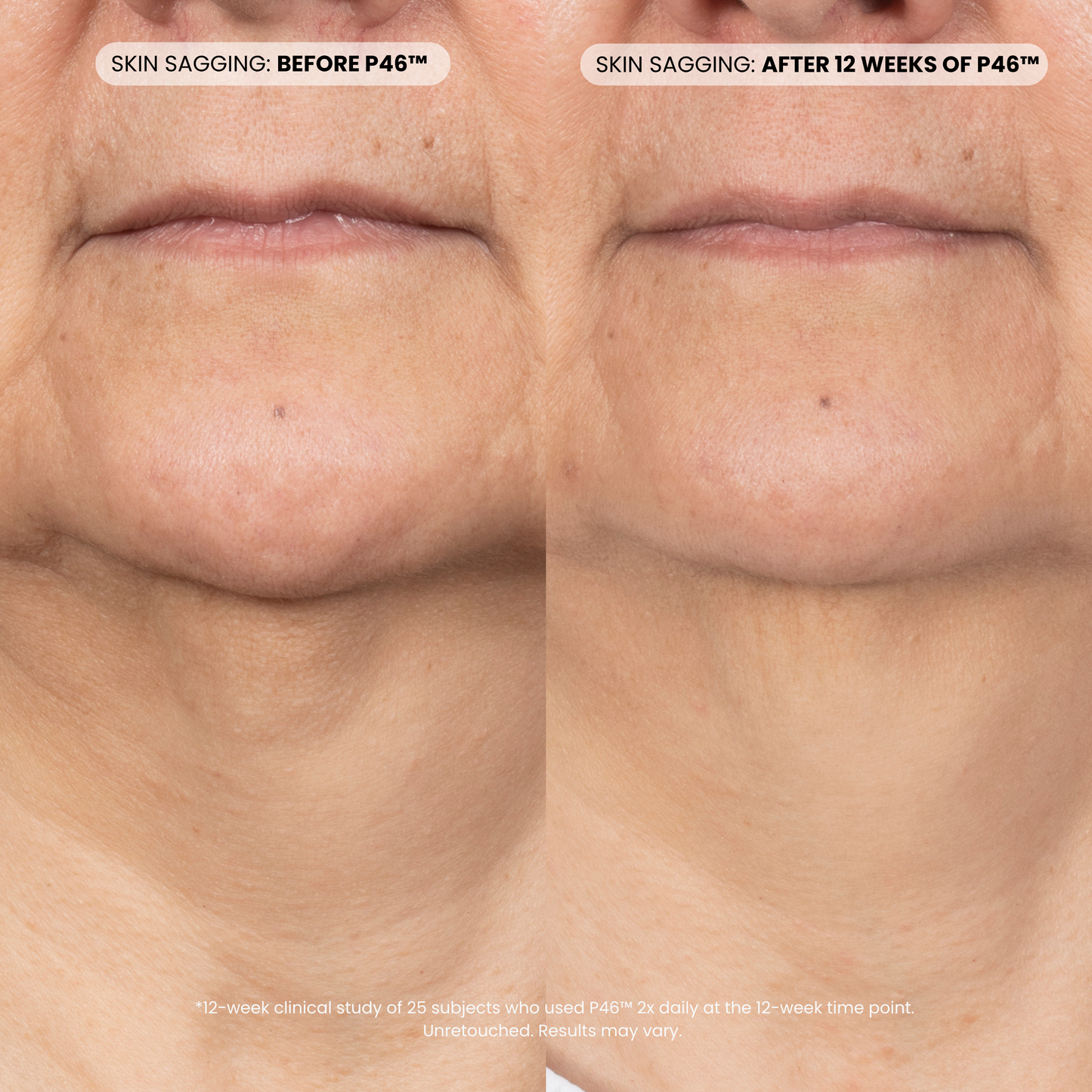 Peptide Plumping Duo